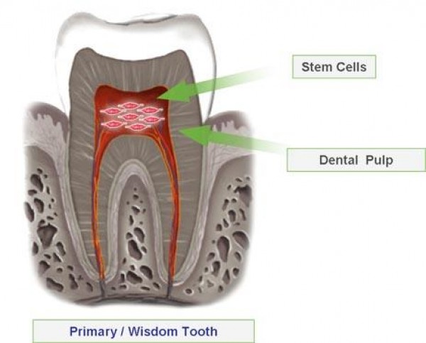 Cellule Staminali di provenienza dalla Polpa Dentale